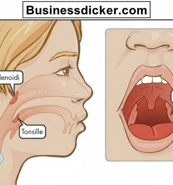Adenoidid: Causes, Symptoms, Diagnosis, and Treatment Explained